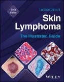 Download Book Skin Lymphoma : The Illustrated Guide - E-Book - PDF