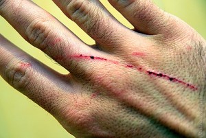 Spin doctors say the wound is very very serious.