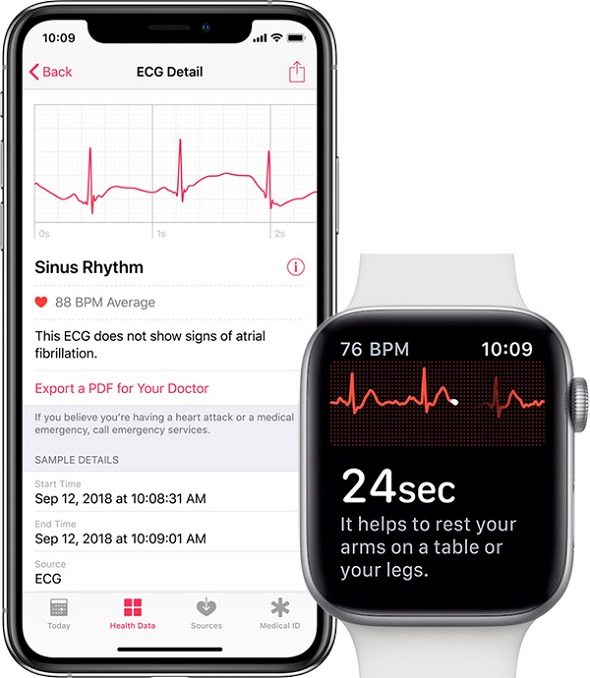 Preste atención antes de comprar el Apple Watch de cuarta generación -  iPhone Islam