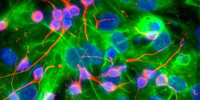 What are stem cells? Definition & applications - The Niche