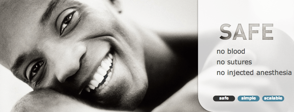 PrePex – обрезание без хирургического вмешательства