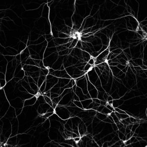 neuronas