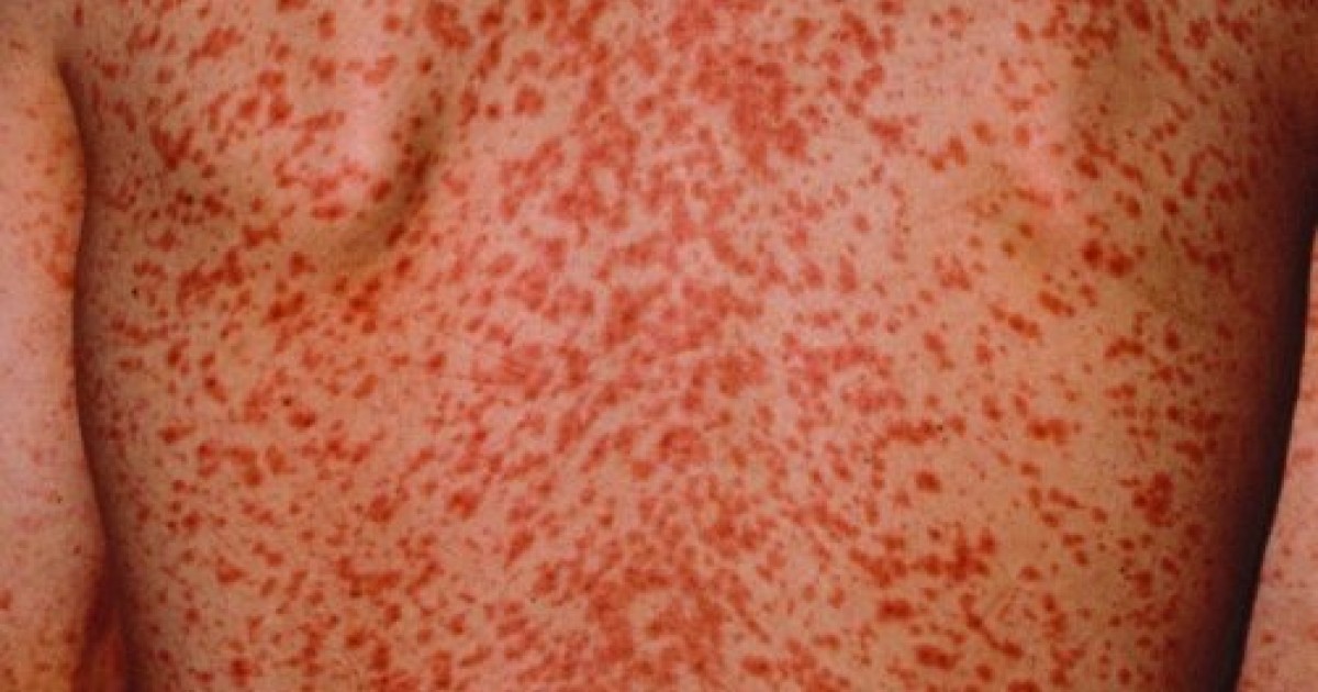 leetrid_2_4