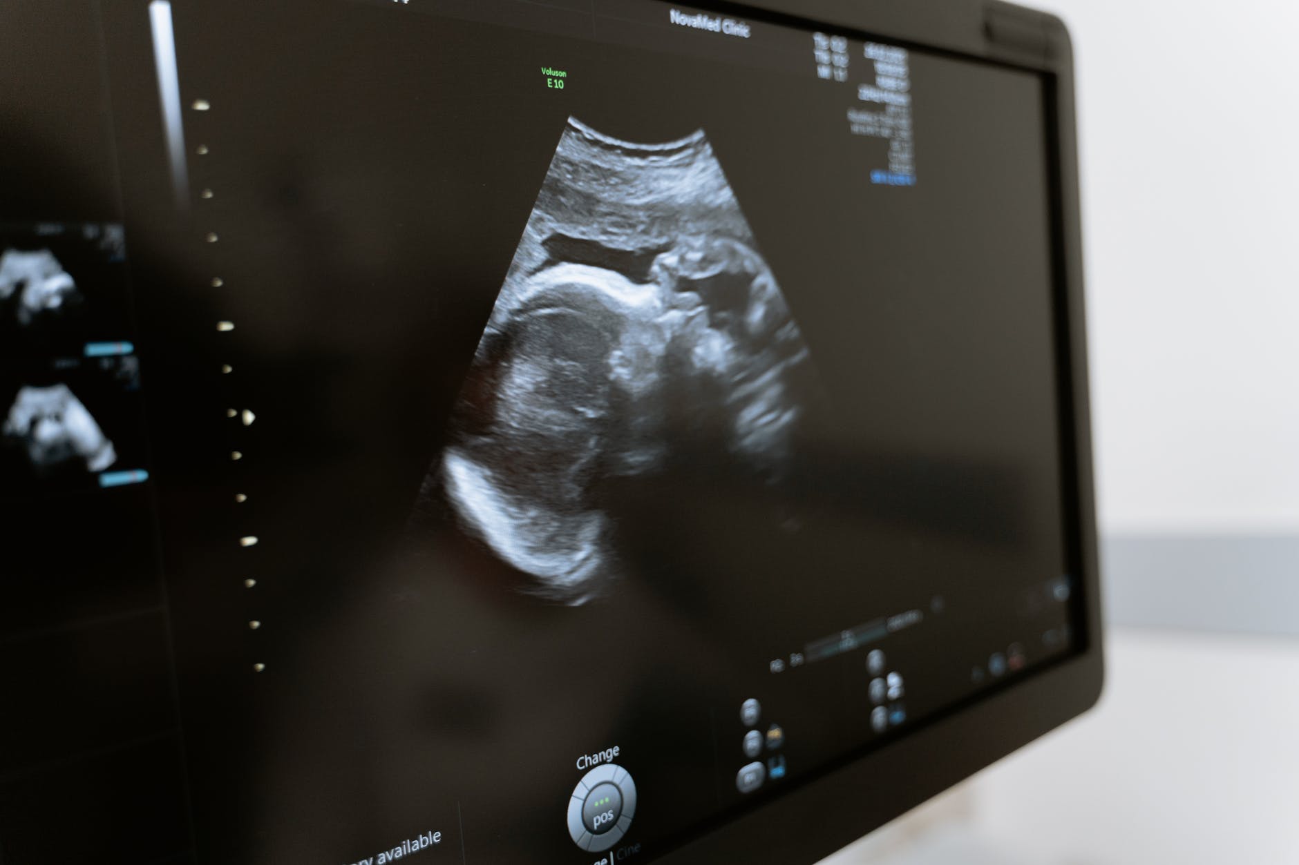 antenatal appointments