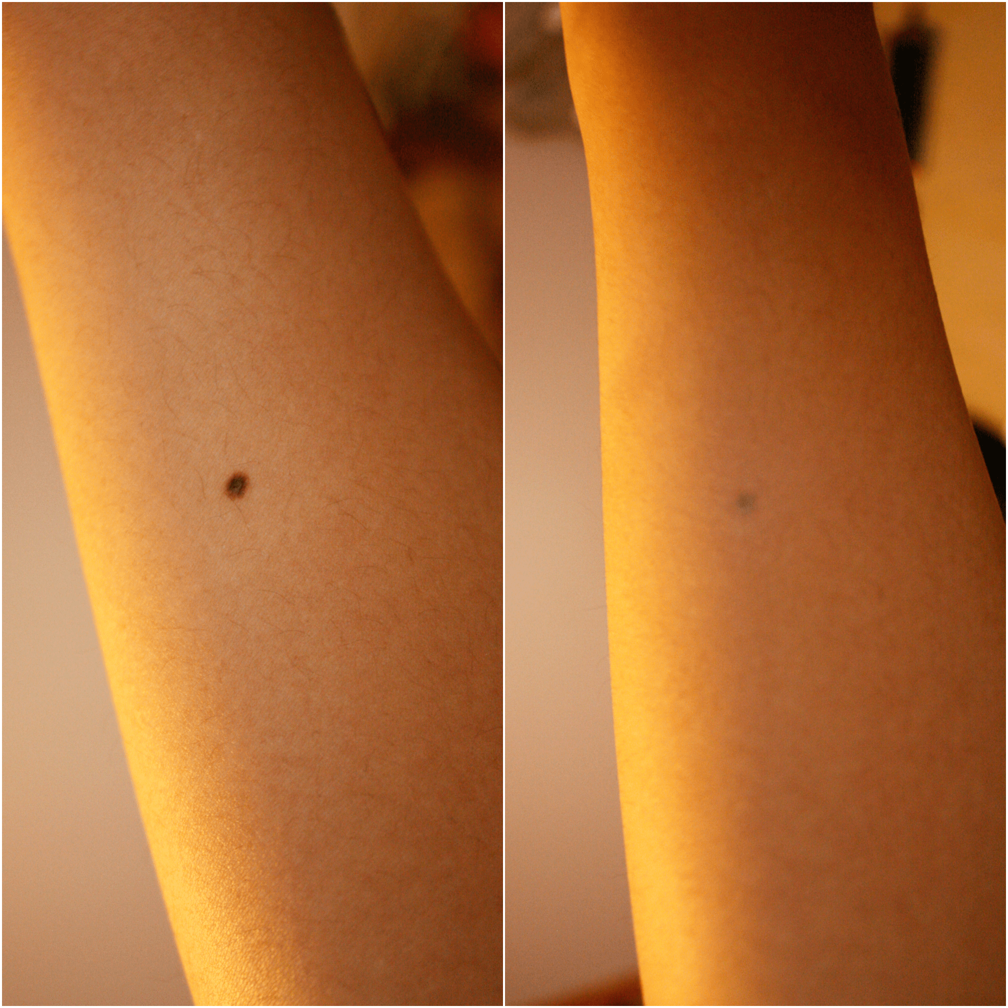 First Impressions | Kat Von D Lock-It Tattoo Concealer – Jrf 2000_x_2000_png