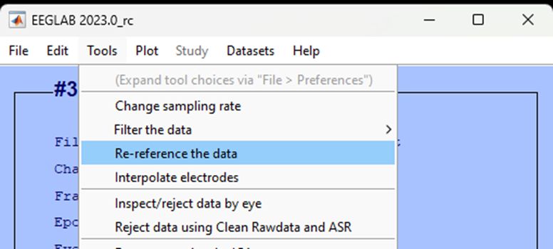 Eeg Analysis Re Reference - Premium Full HD Colorful Textures | Free Download