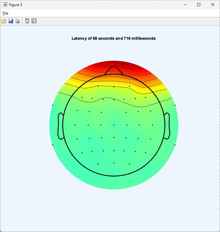 Eeg Analysis Ica - Amazing Colorful Illustration - Ultra HD