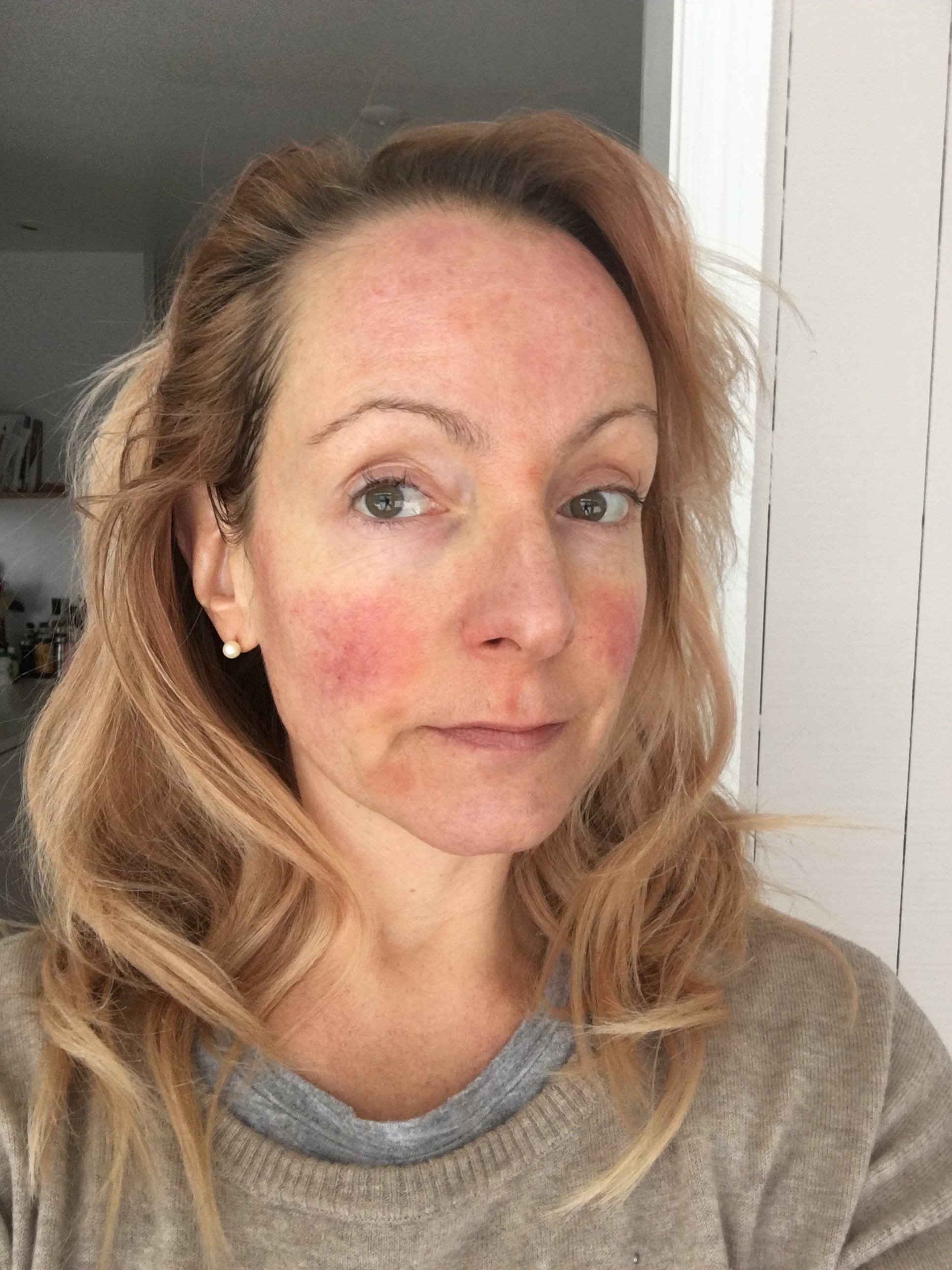 images Celery Juice Skin Before And After my 30 day medical medium celery juice