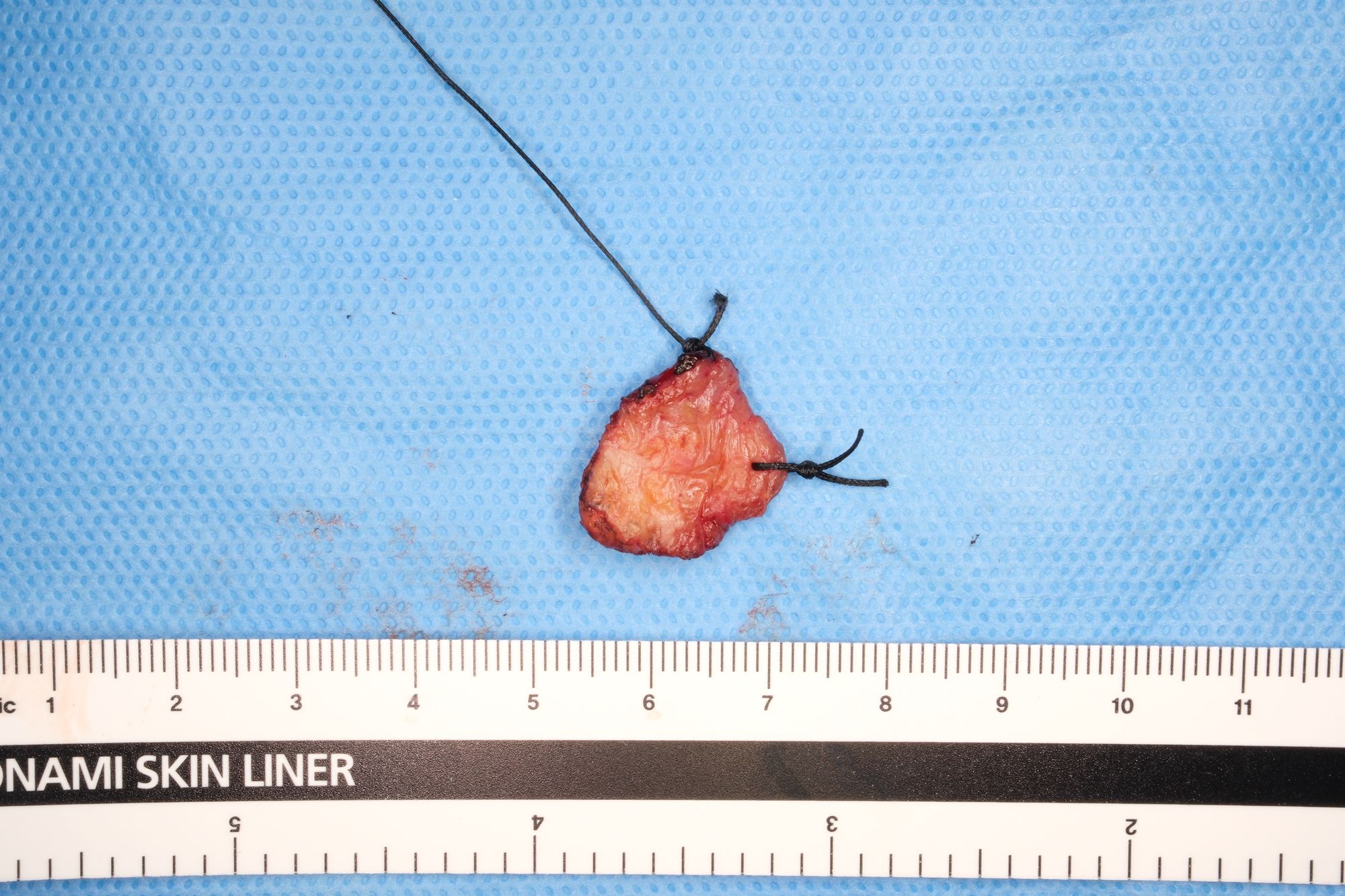 경계를 따라 제거