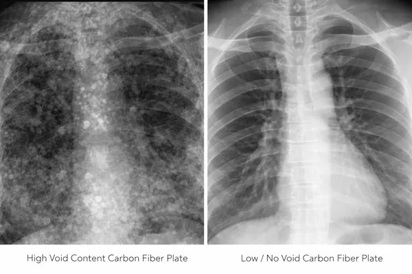 Xray image carbon fibre plate with voids