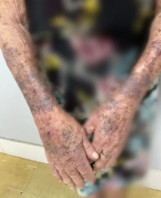 Foto: PCGO/Divulgação