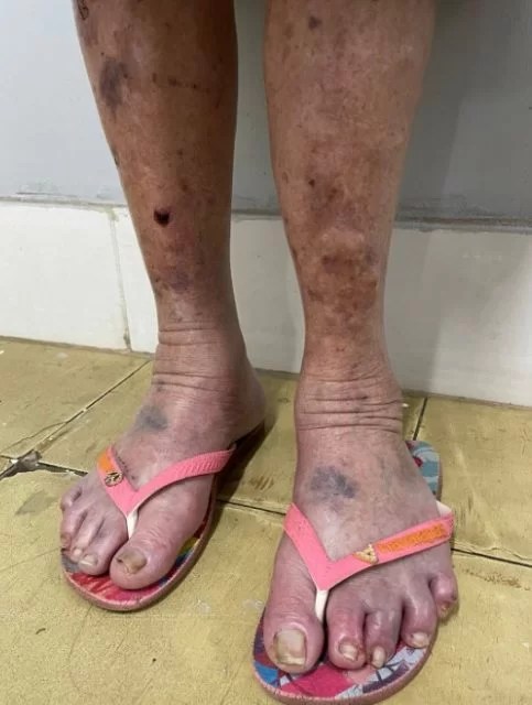 Foto: PCGO/Divulgação