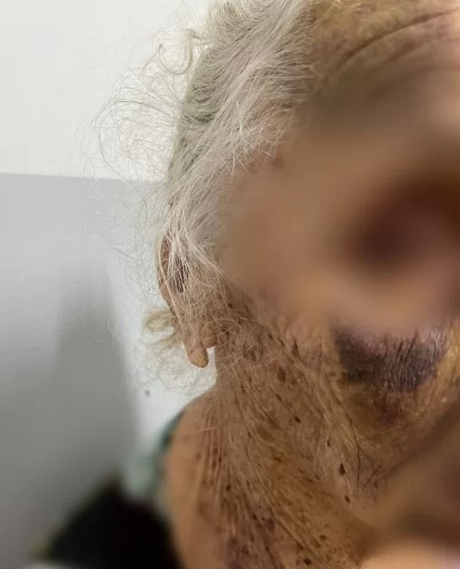 Foto: PCGO/Divulgação