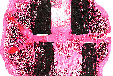 Histologie: Bih - Julius Wolff Institut Für Biomechanik Und Muskuloskeletale Regeneration - Charité – Universitätsmedizin Berlin 250_x_371_jpg