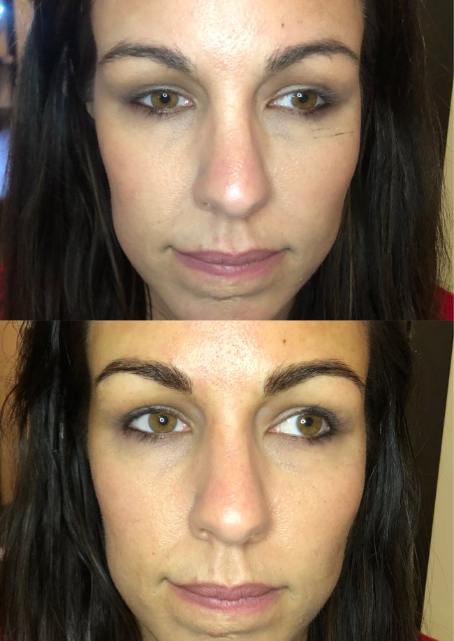 Microblading 