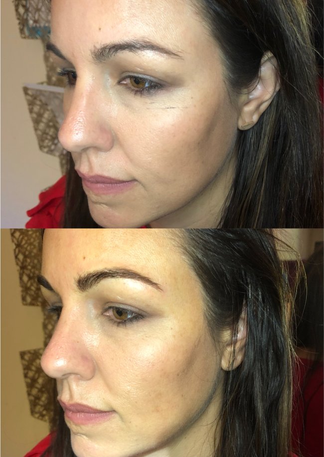 Microblading 