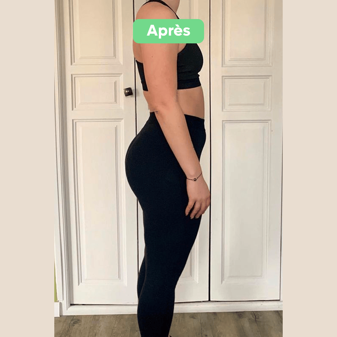 Après - Transformation 20