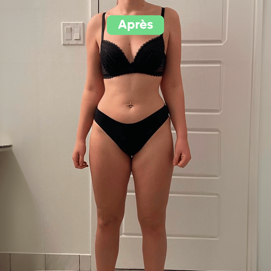 Après - Transformation 23
