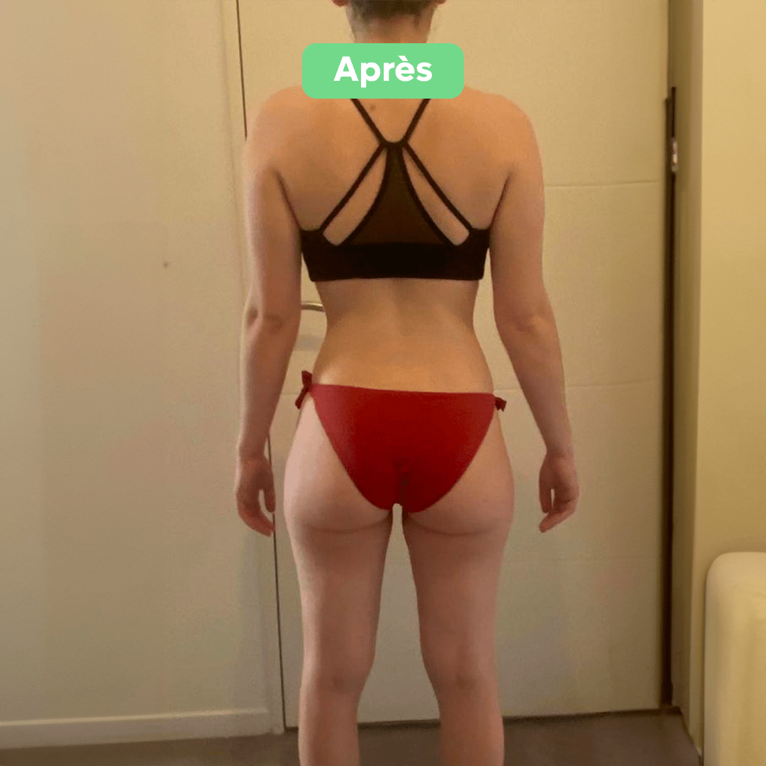 Après - Transformation 30