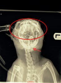 Maximus xray showing his broken jaw & multiple skull fractures (annotated)
