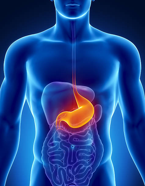 stomach cancer