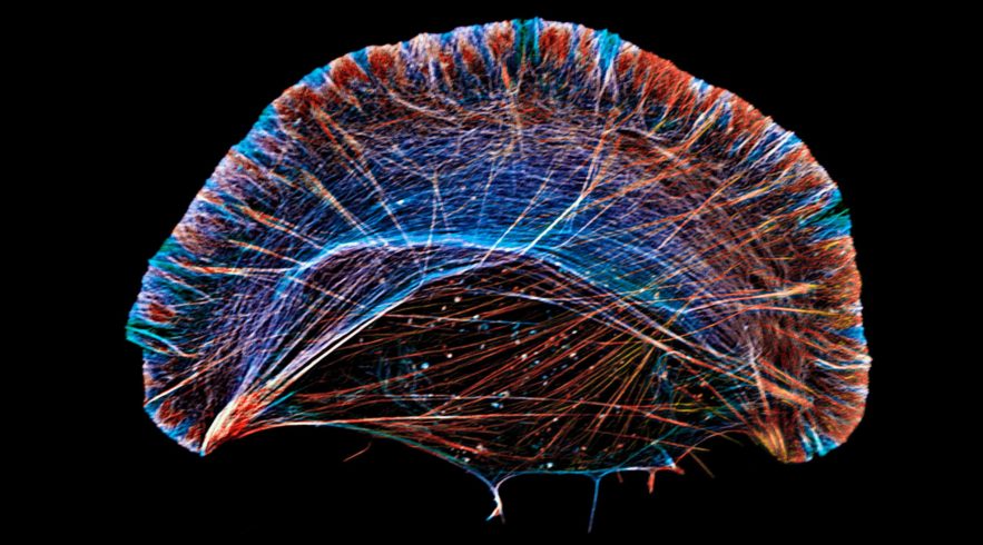 The Astonishing Truth About Moving Cells - j03kv2p