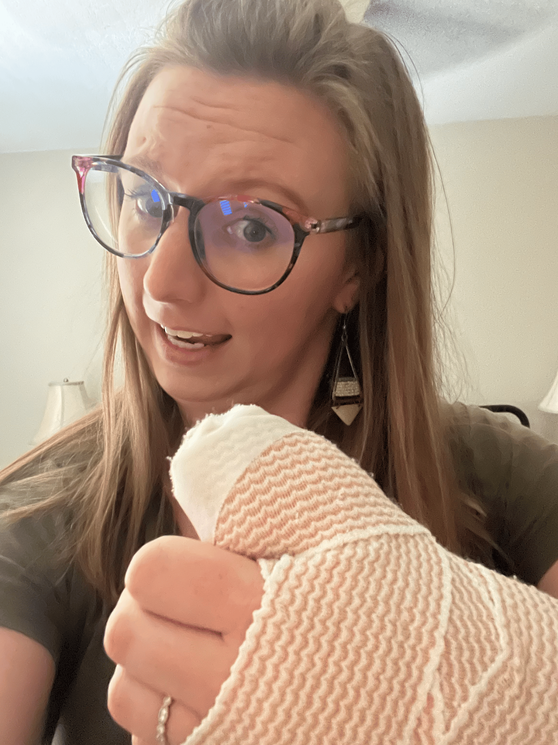 woman shows surgery cast from de quervains release and carpal tunnel surgery
