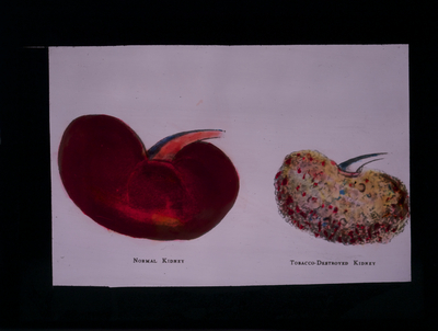 The key is to watch portions, balance what you eat, and have about the same nu. Effects of Alcohol and Cigarettes | Lantern Slides