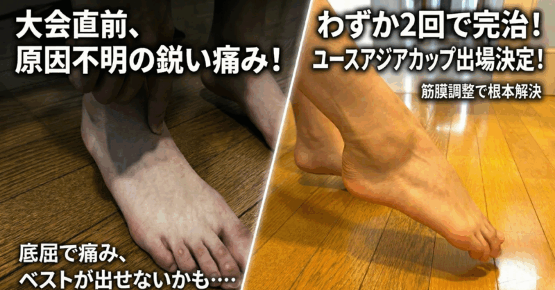 大会直前に襲った“捻挫後遺症の痛み”――トップクライマーを救った筋膜へ