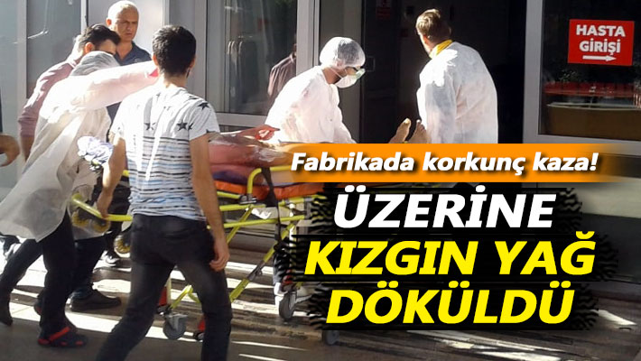 Fabrikada korkunç kaza: Üzerine kızgın yağ döküldü!