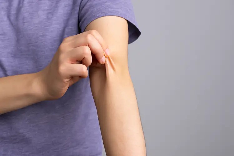 Ehlers-Danlos Sendromu: Bağ Dokusu Hastalığı Nedir ve Belirtileri Nelerdir?