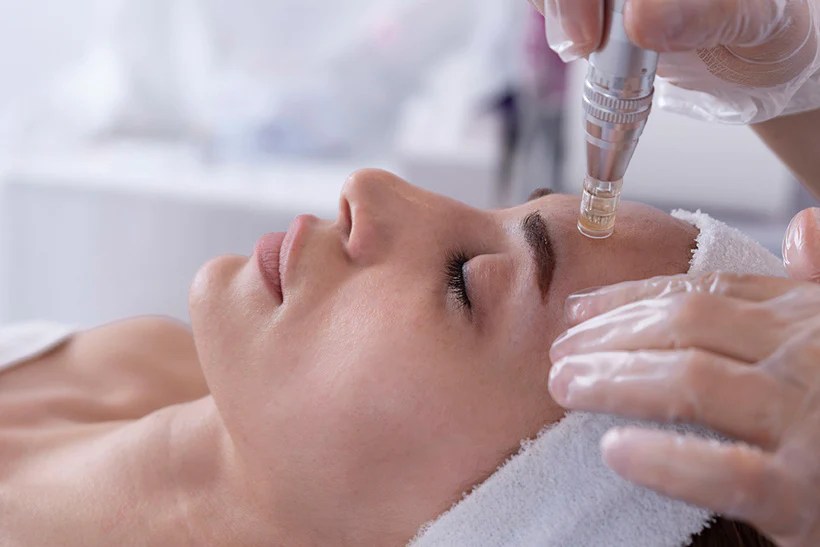 Microneedling Serum