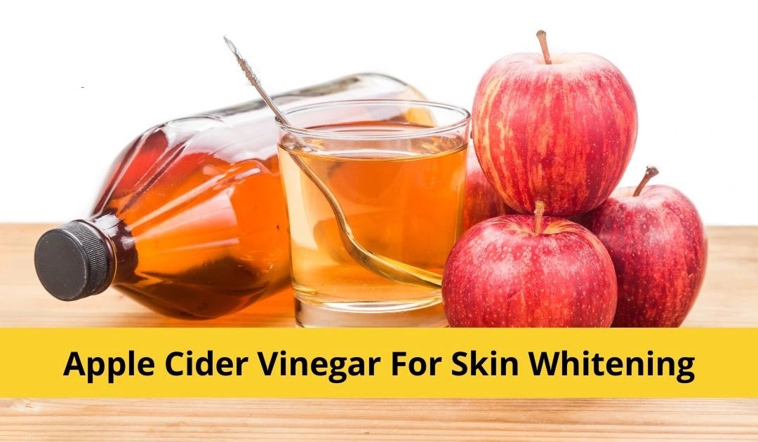 Apple Cider Vinegar for Vitiligo