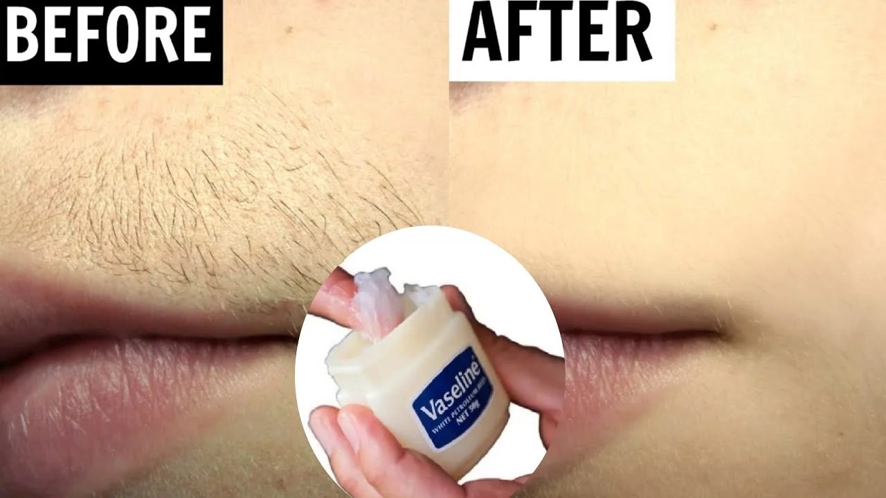 Vaseline Hair Removal