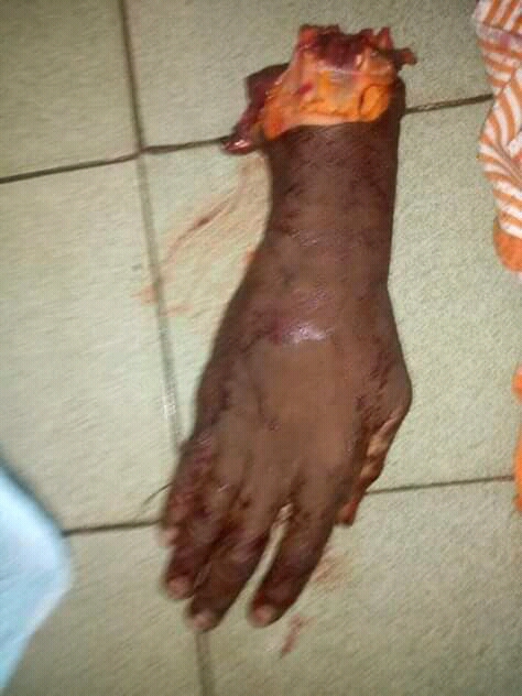 This person's hand went through "Garri Process"