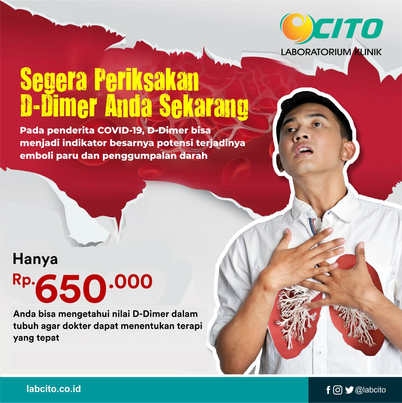 Pemeriksaan darah yang bertujuan untuk mendeteksi awal adanya infeksi virus, mempekirakan status imun dan pemantauan respon pasca vaksinasi. Pemeriksaan D Dimer Laboratorium Klinik Cito