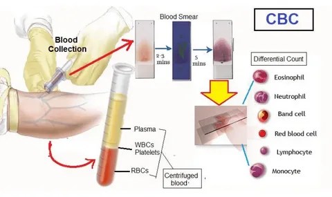 Complete Blood Count
