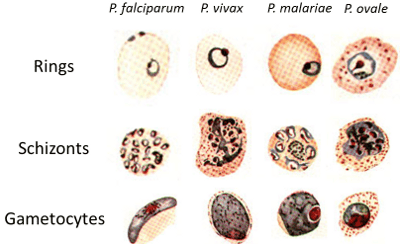 Microlaria Microscope How to report malaria microscopy results - LaboratoryIntern