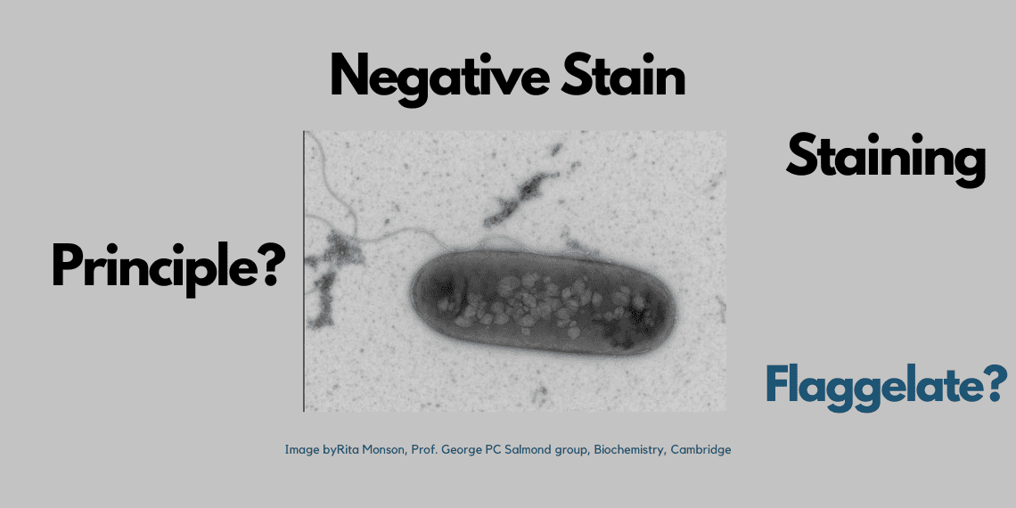Negative staining procedure, principle, and results