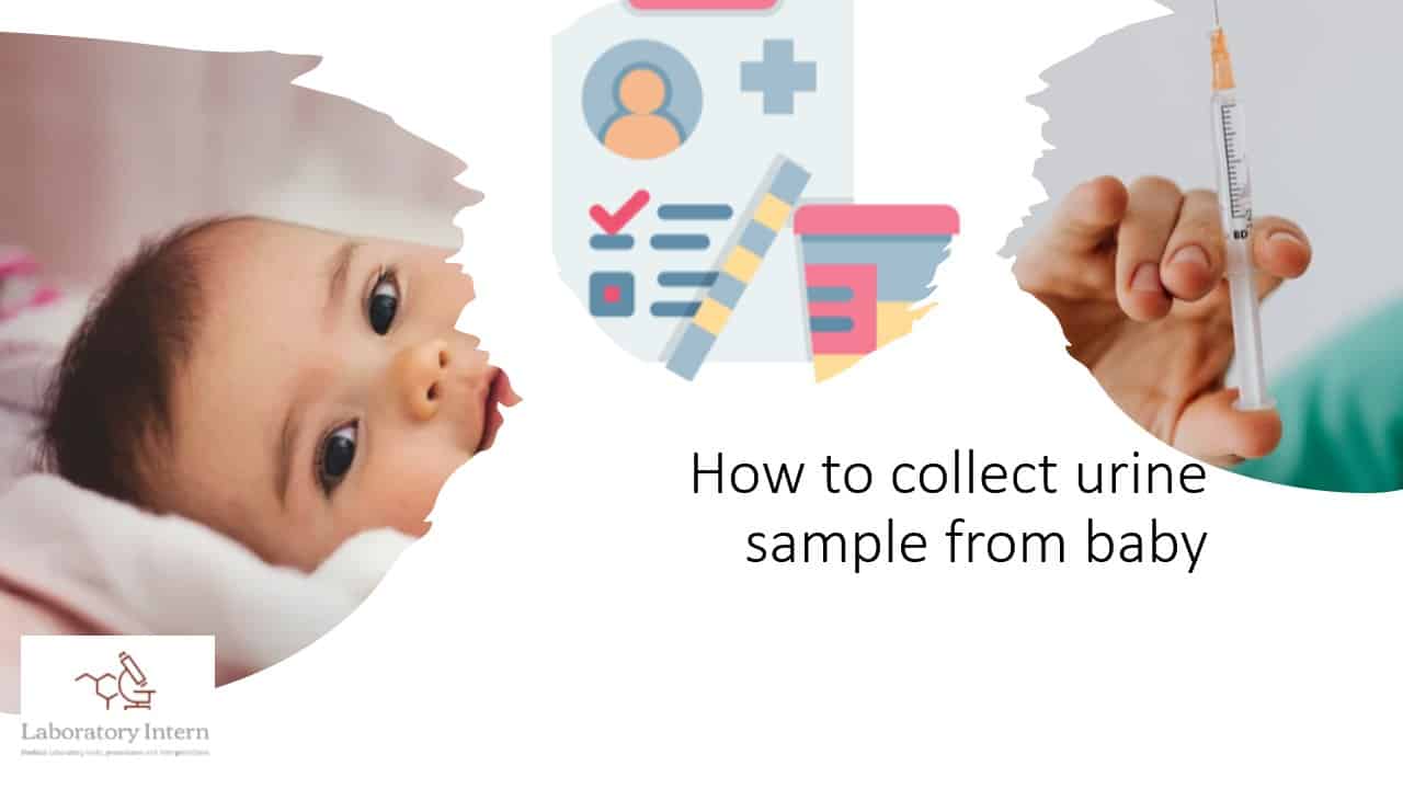 How to collect urine sample from baby (girl and boy)
