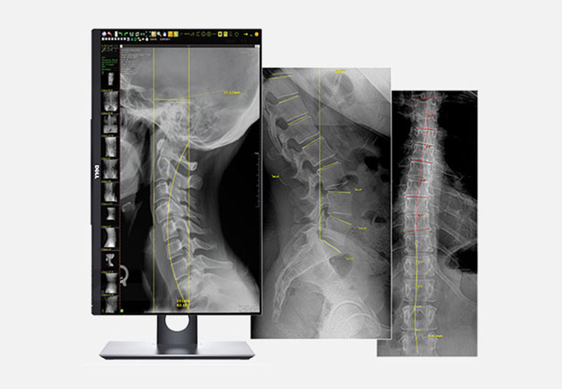 Langley Digital x-Ray