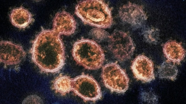 Durham informa el primer caso de una variante de COVID más contagiosa