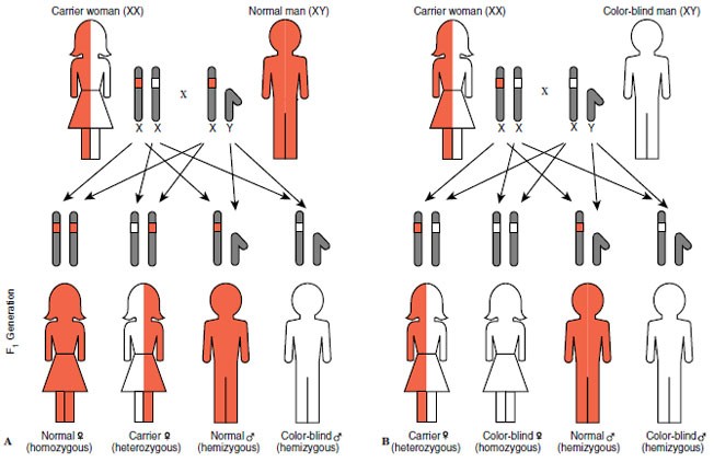26+ Luxury Genetics Color Blindness - Choroideremia | Hereditary Ocular Diseases / Human genetics apply your knowledge of mendelian genetics to humans, and learn about constructing pedigrees, mapping chromosomes, and genetic disorders and much more. 26+ Luxury Genetics Color Blindness - Choroideremia | Hereditary Ocular Diseases / Human genetics apply your knowledge of mendelian genetics to humans, and learn about constructing pedigrees, mapping chromosomes, and genetic disorders and much more.