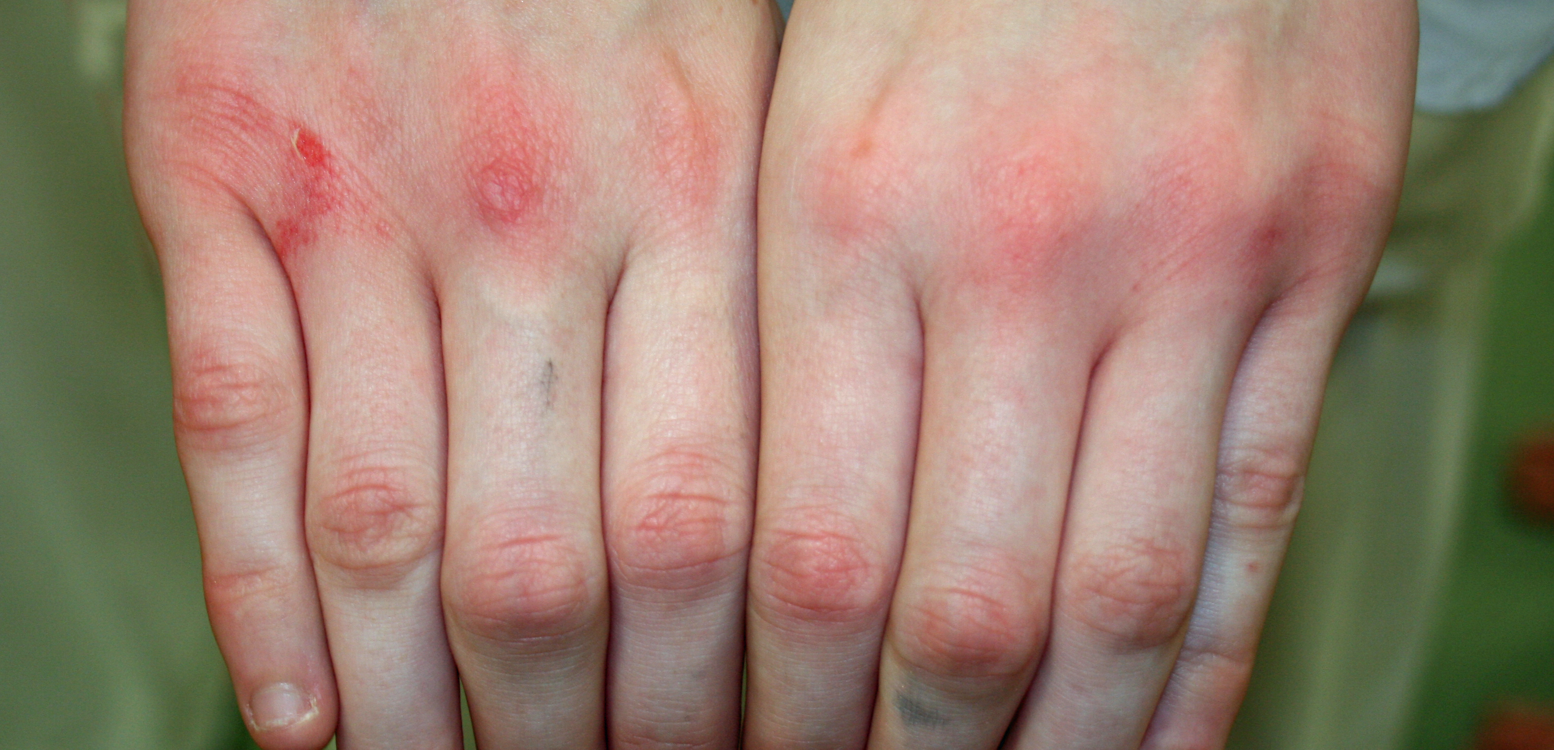 Meghans Hands
