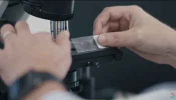 21st Century Revolutionizing Cancer Detection with AR Microscope Driven by AI