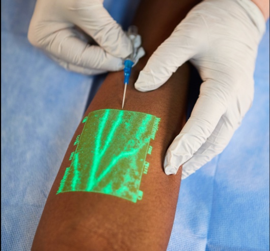 кальций хлор уколы внутривенно. переливание крови в ягодицу. кальция хлорид дальхимфарм. особенности введения хлористого кальция.