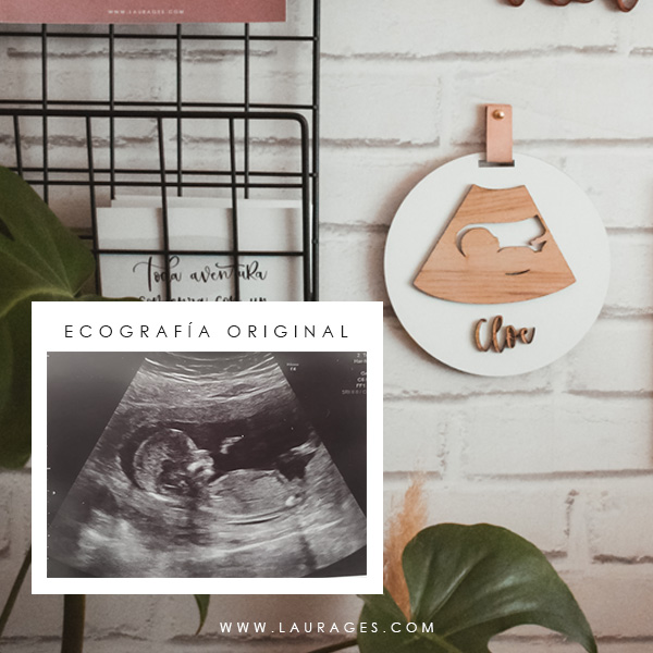 ECOGRAFIA DE MADERA