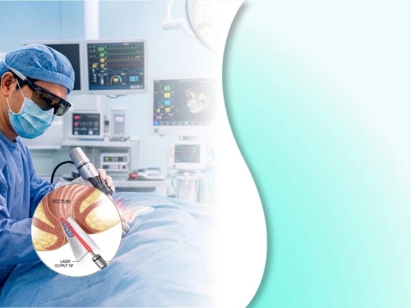Prosedur tindakan Laser LHP untuk mengecilkan benjolan wasir dari dalam secara cepat dan minim pendarahan.