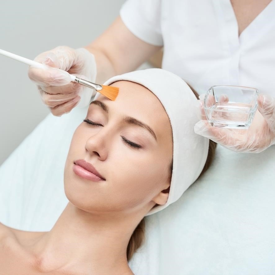 IMG_7029 Facial peel Stirling