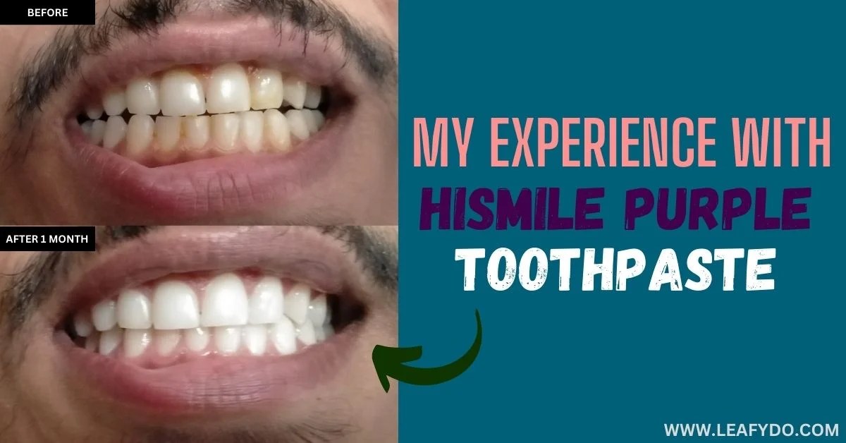 Hismile Purple Toothpaste Review. Know What Customer Says., hi smile - Vimarsana News